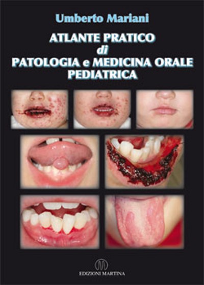 ATLANTE PRATICO di PATOLOGIA e MEDICINA ORALE PEDIATRICA